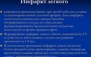 Пневмония у больных перенесших инфаркт миокарда