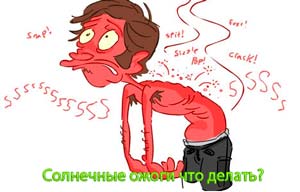 солнечные ожоги что делать?
